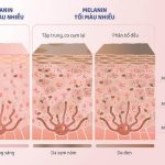 Mua thuốc chữa trị bệnh bạch biến Meladinine Pháp toàn quốc