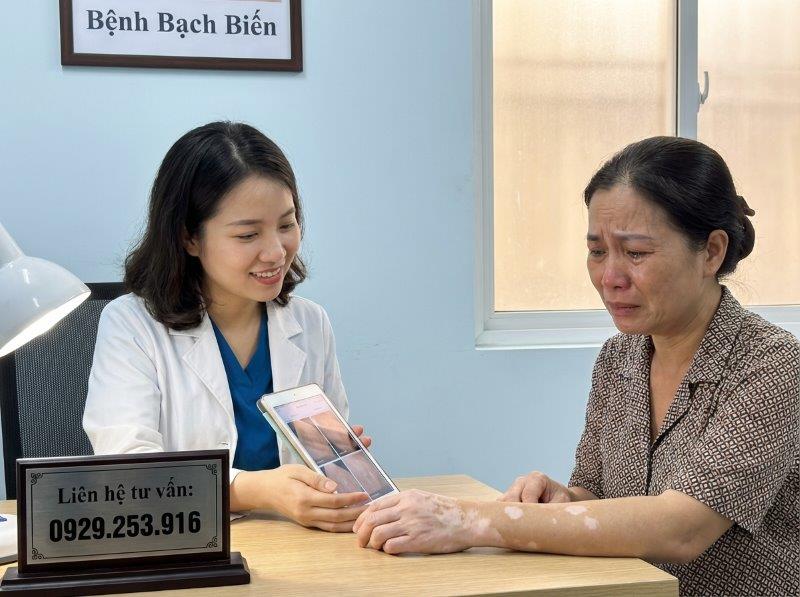huong dan dieu tri benh bach bien vitiligo 1