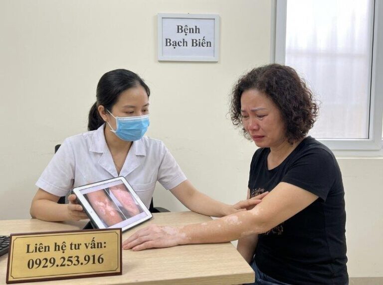 huong dan dieu tri benh bach bien vitiligo 2