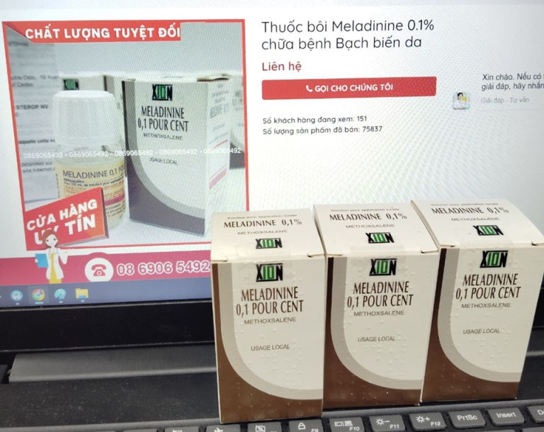 Tổng quan về bệnh bạch biến vitiligo 12 tong quan ve benh bach bien vitiligo.2