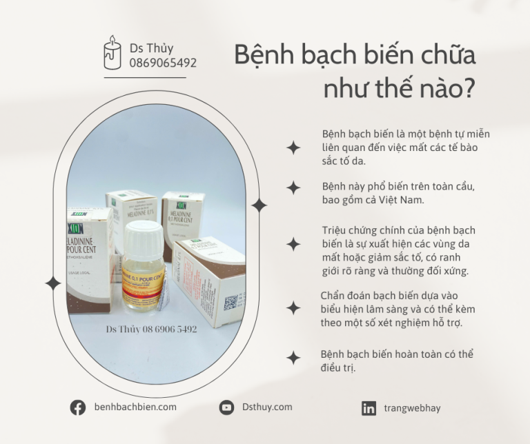 Bệnh bạch biến chữa như thế nào? 14 benh bach bien chua nhu the nao