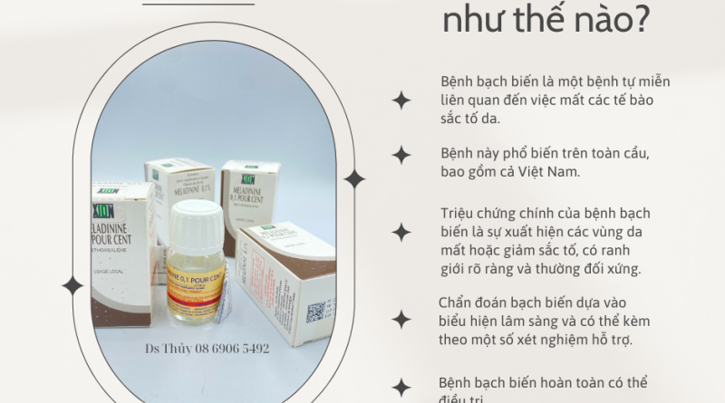 Bệnh bạch biến chữa như thế nào?