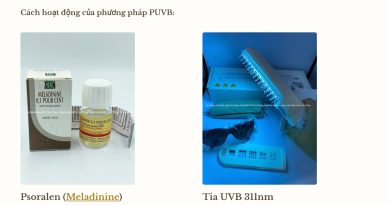 Phuong phap PUVB 1