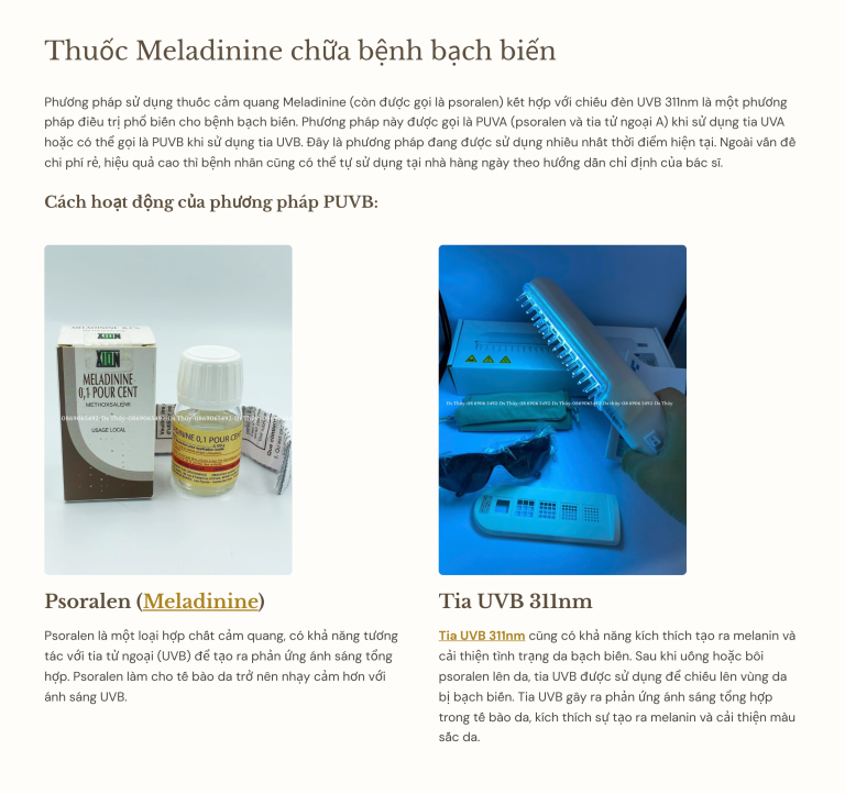 Thuốc Meladinine chữa bệnh bạch biến 11 Phuong phap PUVB 1