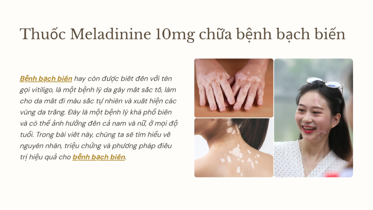 Thuốc meladinine 10mg chữa trị bệnh bạch biến 13 Thuoc meladinine 10mg chua tri benh bach bien