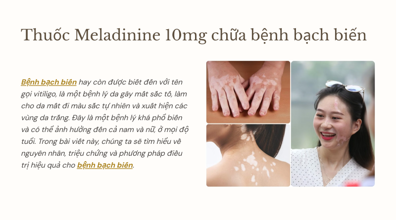 Thuoc meladinine 10mg chua tri benh bach bien